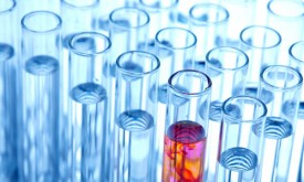Reagenzgläser bei einem Versuch im Chemie Labor