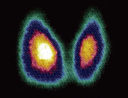 izotop scan