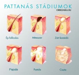pattanas_stadiumok_fajtak
